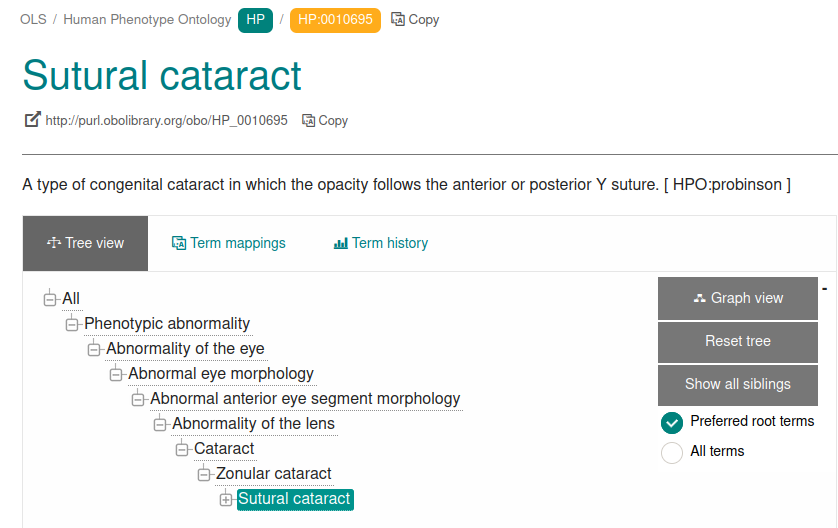 OLS view of sutural cataract