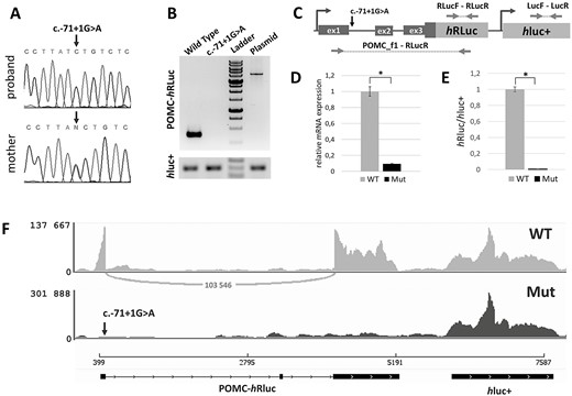 POMC 5' UTR splicing